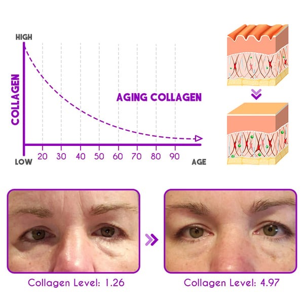 Pro-Xylane Active Eye Cream
