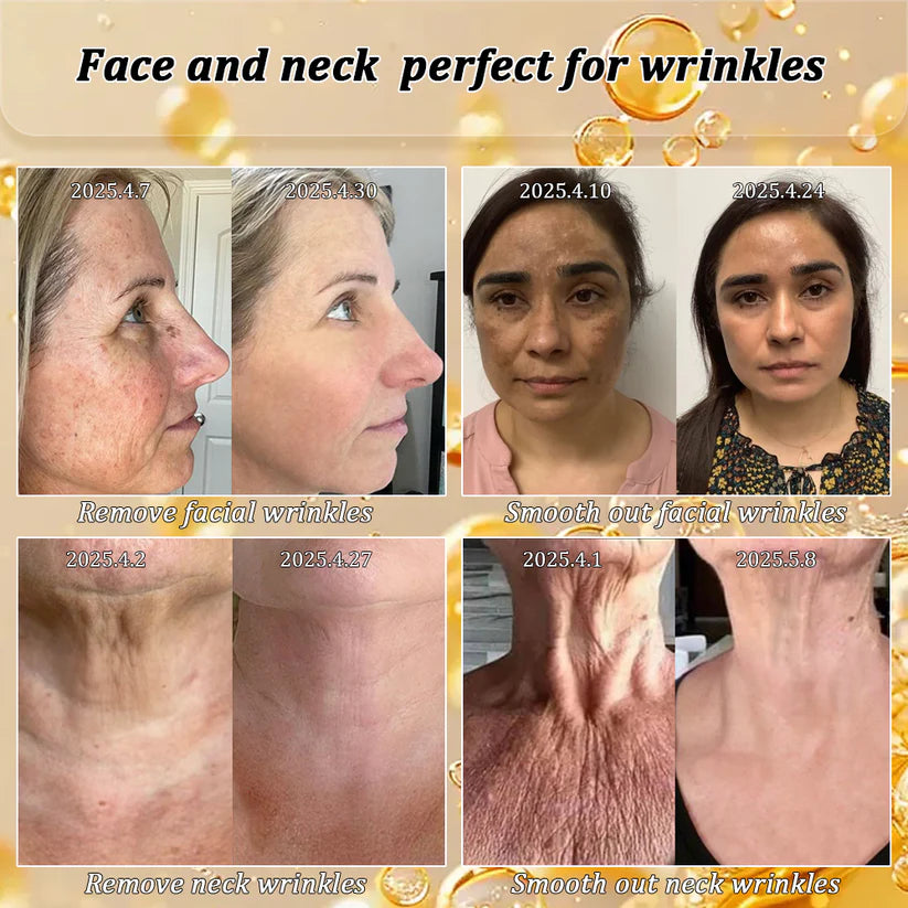 LAOZIKTM Anti-Glycation Guard Firming Cream: Dermatologist Reveals the True Culprit of Sagging Skin After 40đ„