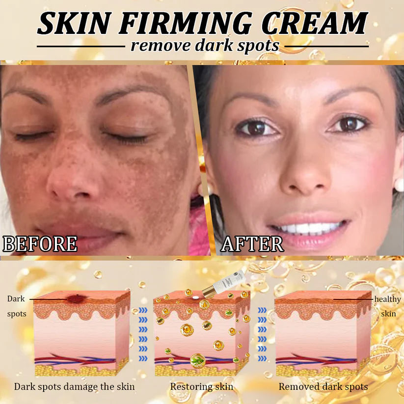 LAOZIKTM Anti-Glycation Guard Firming Cream: Dermatologist Reveals the True Culprit of Sagging Skin After 40đ„
