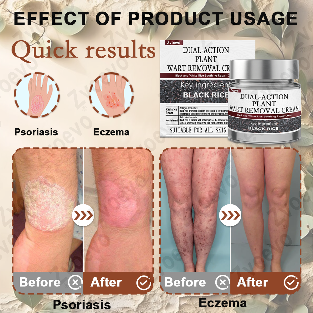 Zvoevo® Rice Bran Essence Cream⚕️ FDA-approved (removes warts and skin tags, improves keratin buildup and skin hyperplasia, follicular keratosis, skin cancer, and age spots)