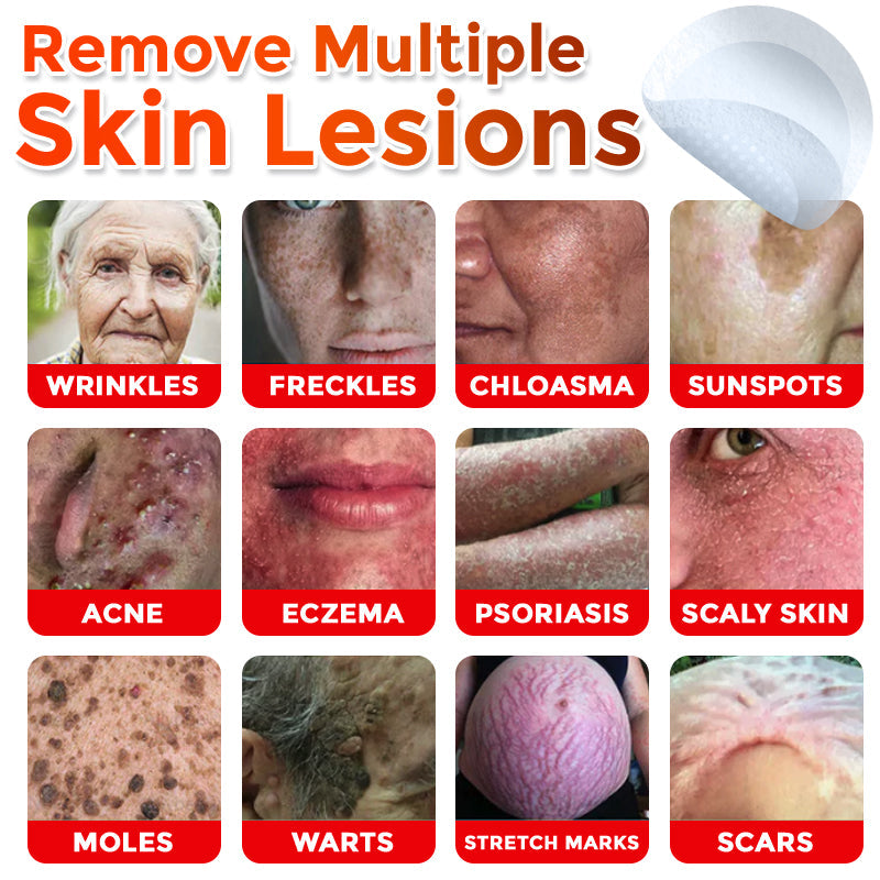 MicroNeedle Plant-based Skin Tag Removal Patch 🇺🇸 Made in the USA