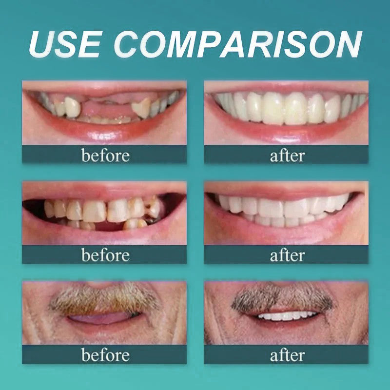 šYUNPSOTM Premium Dentures (Limited Time Offer)š¦·